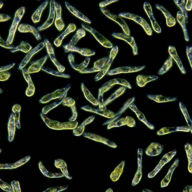Veelzijdige micro-alg: van circulaire biobrandstof tot oplossing ondervoeding in Bangladesh
